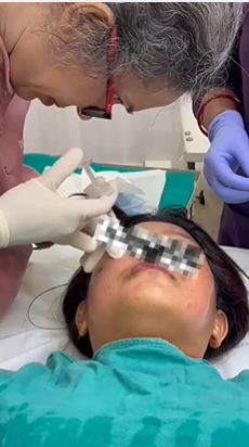 Clinical Microneedling & Face Procedure Training