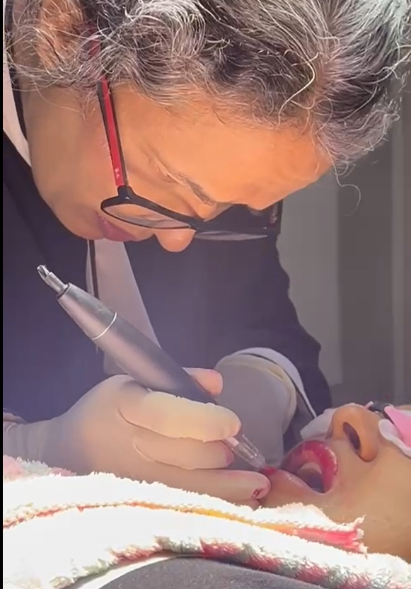 Clinical Laser Hair Reduction Demonstration